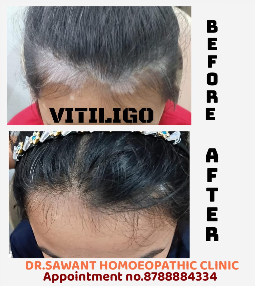 Patient-shared clinical progress photograph